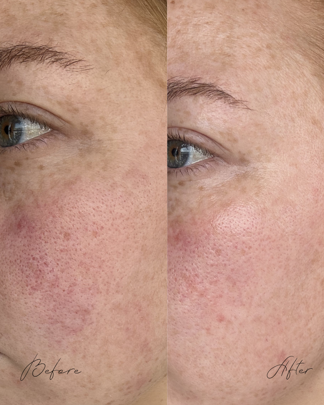 Aquarius Peptide Renewal Serum